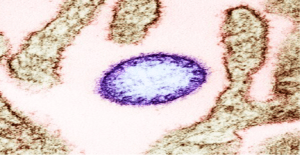 6th Nipah Virus Outbreak in Kerala: 24-Year-Old Student Dies, 175 People Identified as Contacts 1 6th Nipah Virus Outbreak in Kerala: 24-Year-Old Student Dies, 175 People Identified as Contacts