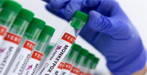 Mpox Case Reported in Kerala: Patient Stable, Contact Tracing Ongoing 1 Mpox Case Reported in Kerala: Patient Stable, Contact Tracing Ongoing